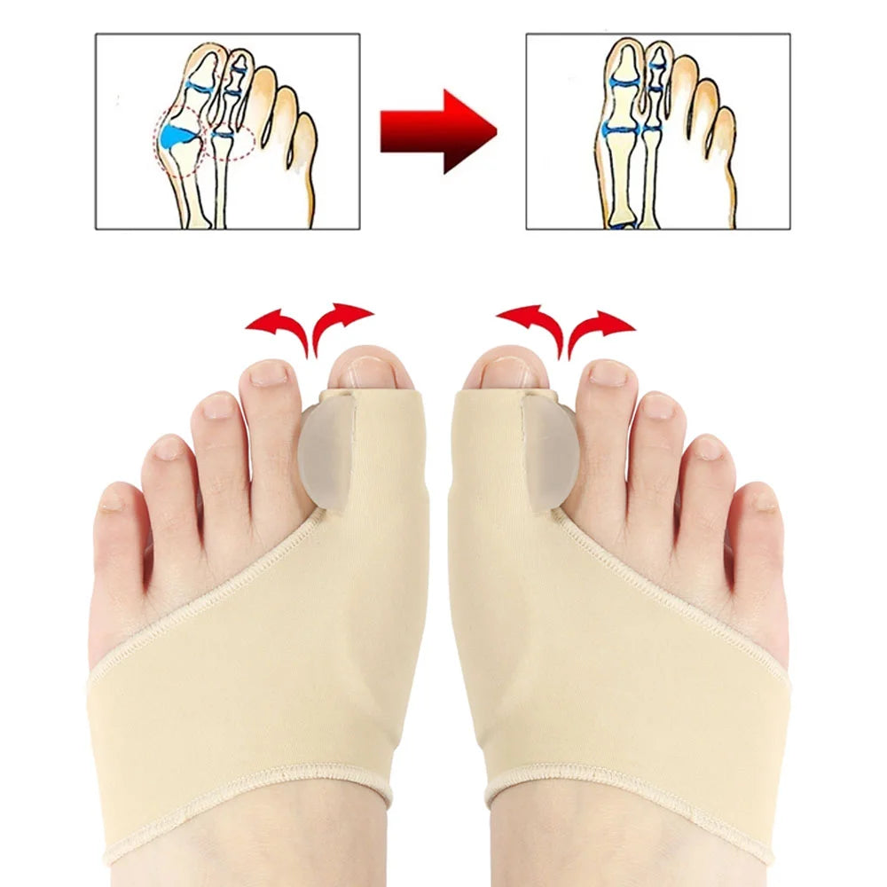 2Pcs Toe Separator Hallux Valgus Bunion Corrector Orthotics Feet Bone Thumb Adjuster Correction Pedicure Sock Straightener Tools